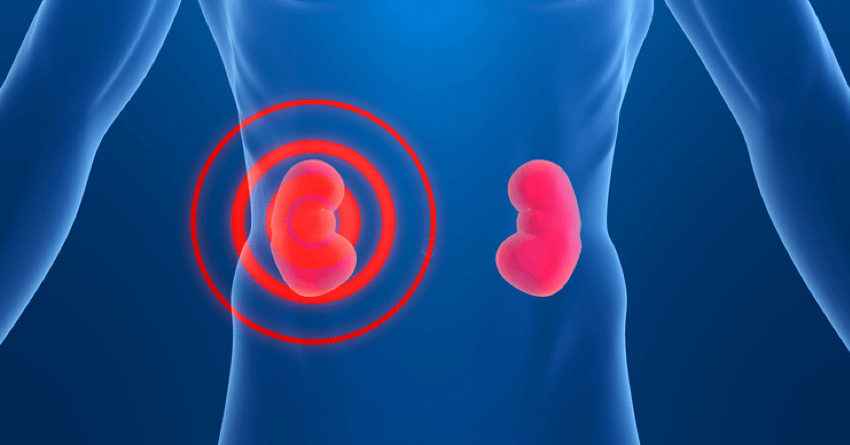 Kidney Disease Symptom