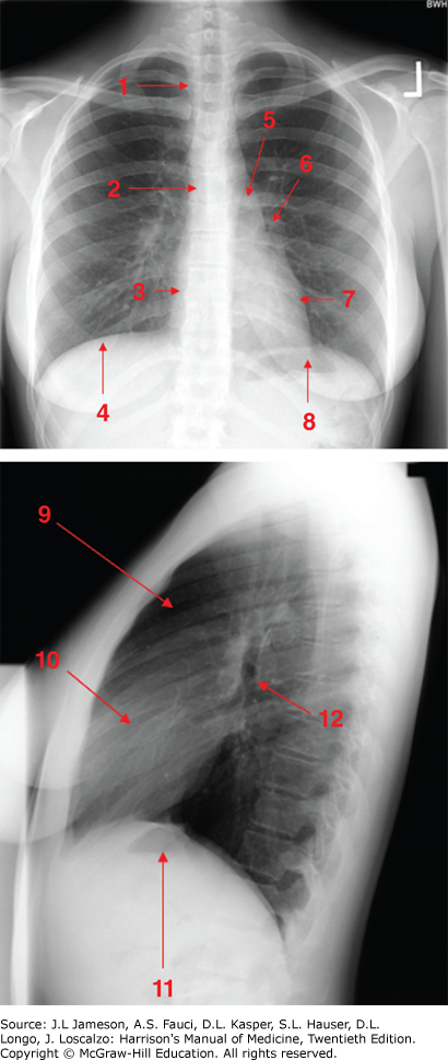 Diagnostic imaging in internal Medicine