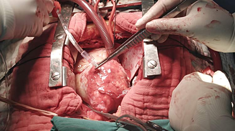 Best Cardiologist in multan near you